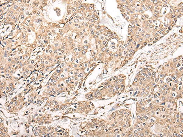NDUFB11 Antibody in Immunohistochemistry (Paraffin) (IHC (P))