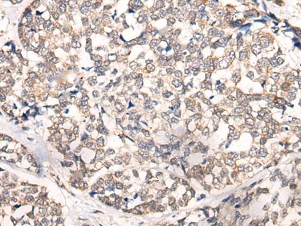 NREP Antibody in Immunohistochemistry (Paraffin) (IHC (P))