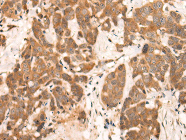 NRG2 Antibody in Immunohistochemistry (Paraffin) (IHC (P))