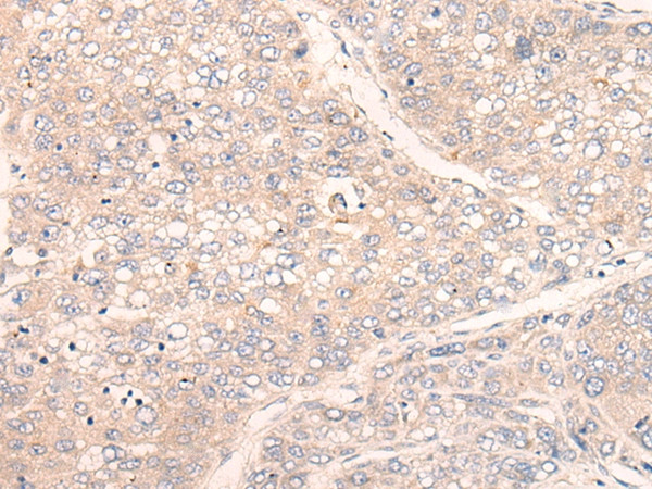 C1orf57 Antibody in Immunohistochemistry (Paraffin) (IHC (P))