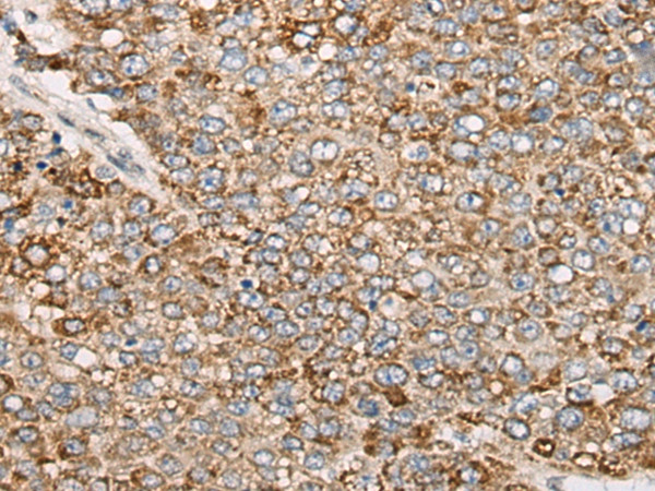 PCDHGB5 Antibody in Immunohistochemistry (Paraffin) (IHC (P))