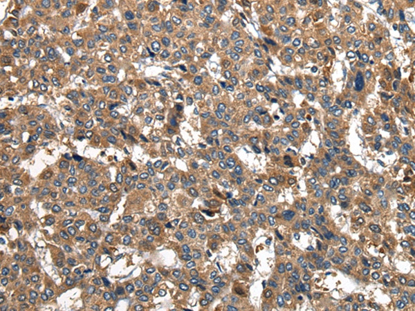 PIWIL2 Antibody in Immunohistochemistry (Paraffin) (IHC (P))