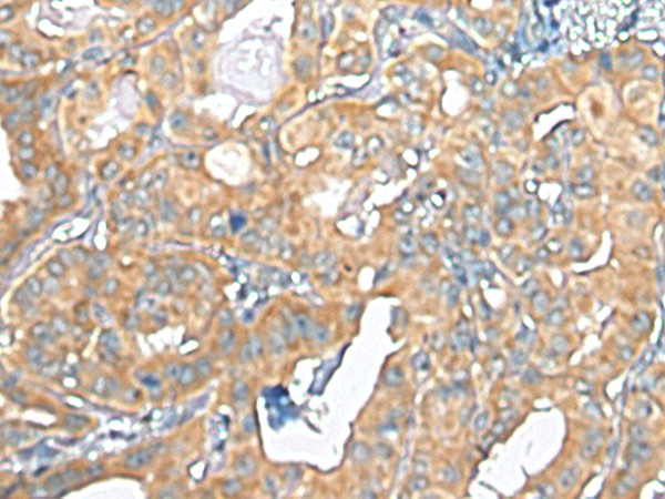 TMEM256 Antibody in Immunohistochemistry (Paraffin) (IHC (P))