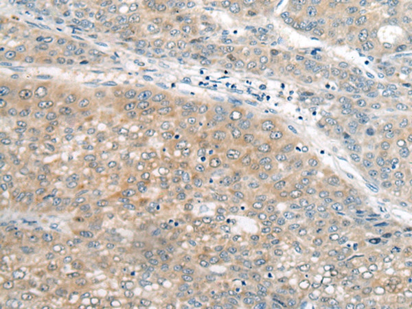 UBE2G2 Antibody in Immunohistochemistry (Paraffin) (IHC (P))