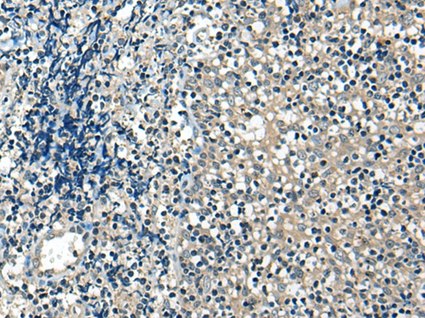 USP12 Antibody in Immunohistochemistry (Paraffin) (IHC (P))