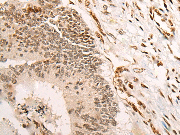 VGLL3 Antibody in Immunohistochemistry (Paraffin) (IHC (P))