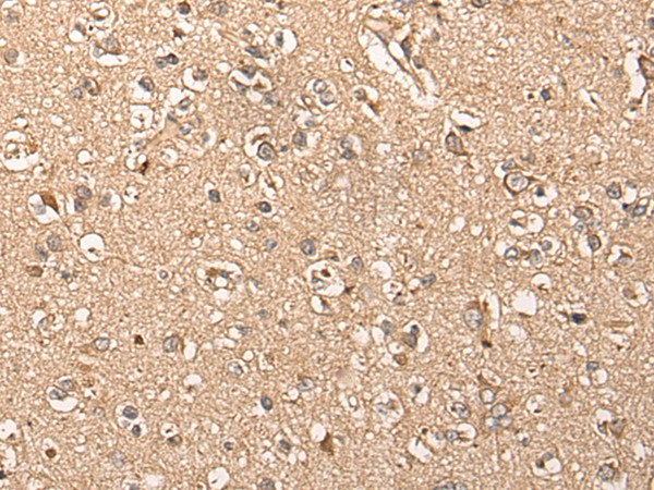 WDFY4 Antibody in Immunohistochemistry (Paraffin) (IHC (P))