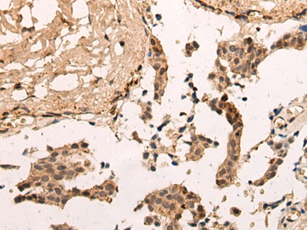 ZNF467 Antibody in Immunohistochemistry (Paraffin) (IHC (P))