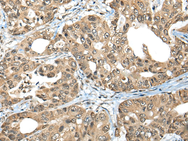ZNF468 Antibody in Immunohistochemistry (Paraffin) (IHC (P))