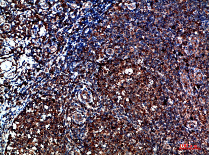 CYFIP2 Antibody in Immunohistochemistry (Paraffin) (IHC (P))