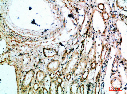 MIB1 Antibody in Immunohistochemistry (Paraffin) (IHC (P))