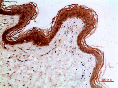 Cytokeratin 14/17 Antibody in Immunohistochemistry (Paraffin) (IHC (P))