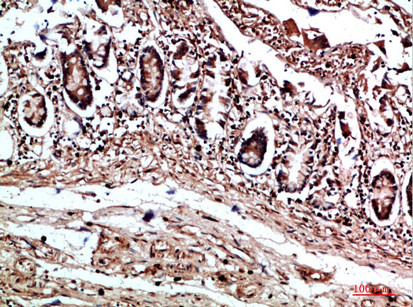 COL17A1 Antibody in Immunohistochemistry (Paraffin) (IHC (P))