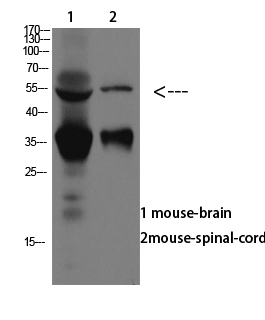 ASIC1 Antibody in Western Blot (WB)