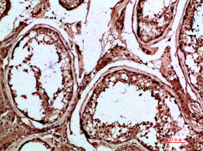 INSL3 Antibody in Immunohistochemistry (Paraffin) (IHC (P))
