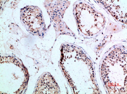 FZD9 Antibody in Immunohistochemistry (Paraffin) (IHC (P))