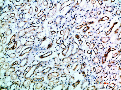 TSPAN7 Antibody in Immunohistochemistry (Paraffin) (IHC (P))