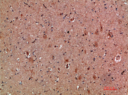 NNT1 Antibody in Immunohistochemistry (Paraffin) (IHC (P))