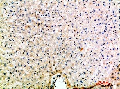 MIP-1 delta Antibody in Immunohistochemistry (Paraffin) (IHC (P))