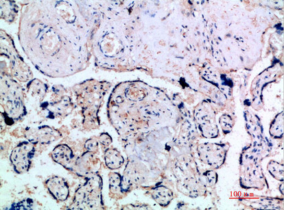 INHA Antibody in Immunohistochemistry (Paraffin) (IHC (P))