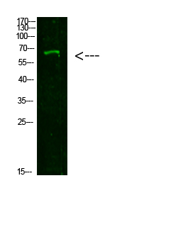 NUTM1 Antibody in Western Blot (WB)
