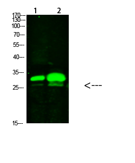 KCTD7 Antibody in Western Blot (WB)