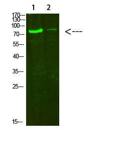 COL8A2 Antibody in Western Blot (WB)