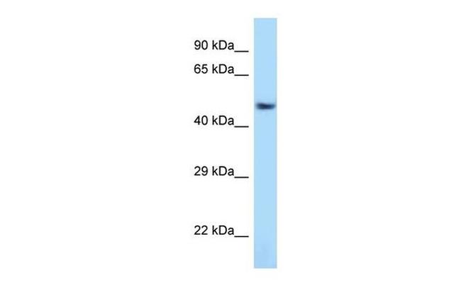 ATF7 Antibody in Western Blot (WB)