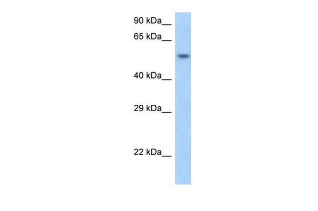 SNAPC1 Antibody in Western Blot (WB)
