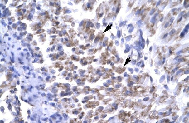 ERCC8 Antibody in Immunohistochemistry (IHC)