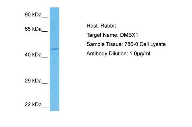 DMBX1 Antibody in Western Blot (WB)