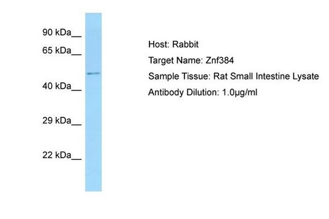 ZNF384 Antibody in Western Blot (WB)