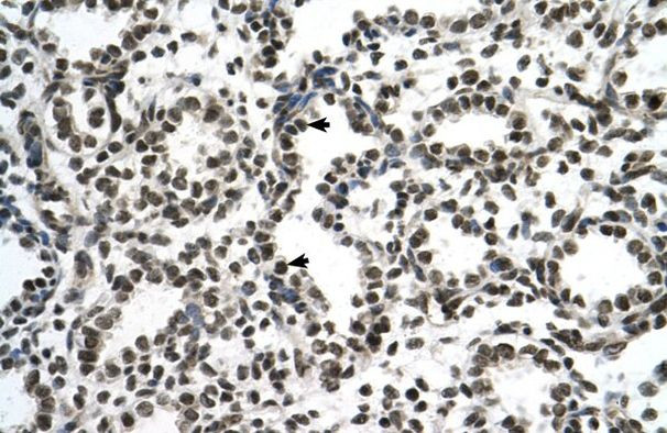 ZNF706 Antibody in Immunohistochemistry (IHC)