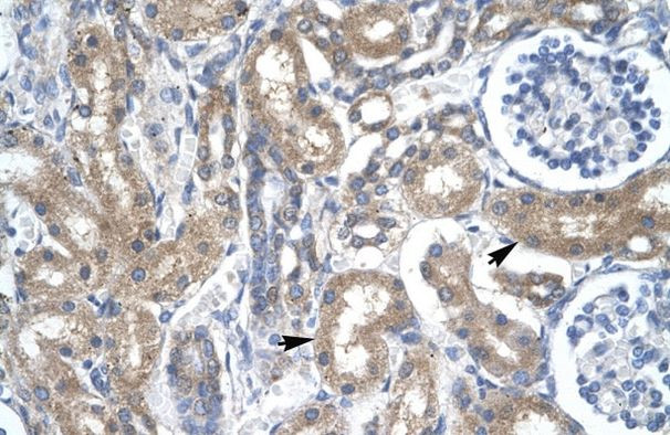 DP2 Antibody in Immunohistochemistry (IHC)