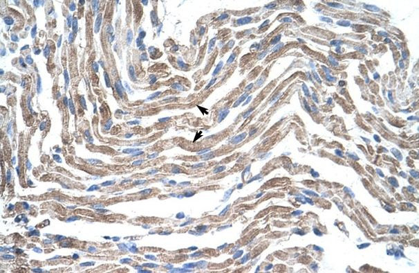 Claudin 11 Antibody in Immunohistochemistry (IHC)