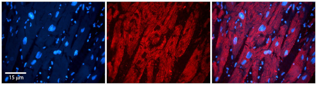 Zyxin Antibody in Immunohistochemistry (Paraffin) (IHC (P))