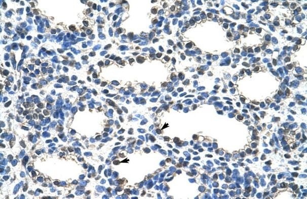 ARIH2 Antibody in Immunohistochemistry (IHC)