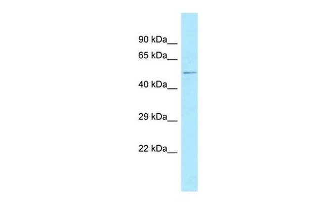 KLHL1 Antibody in Western Blot (WB)