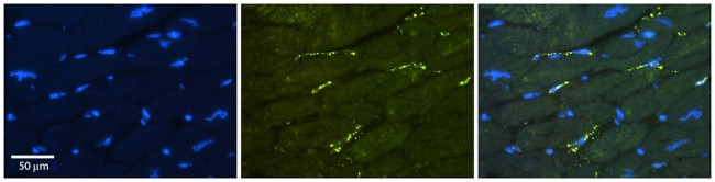 GREB1 Antibody in Immunohistochemistry (Paraffin) (IHC (P))