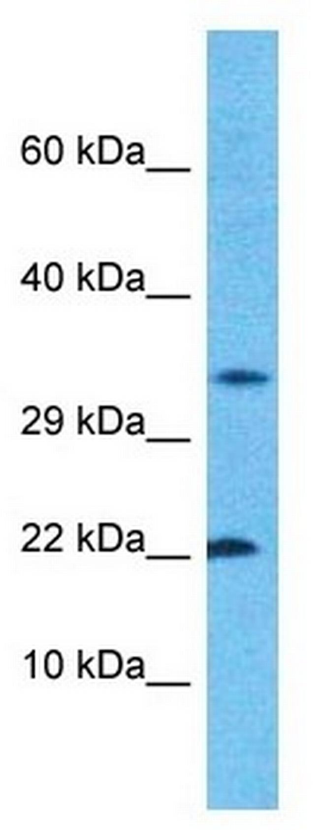 CROC4 Antibody in Western Blot (WB)