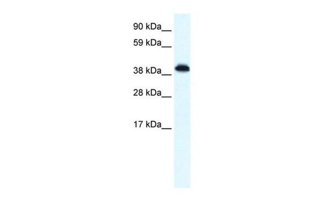ZNF568 Antibody in Western Blot (WB)