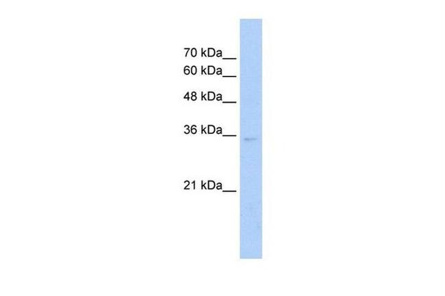 ZNF547 Antibody in Western Blot (WB)
