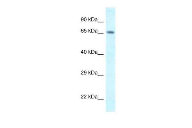 SHKBP1 Antibody in Western Blot (WB)
