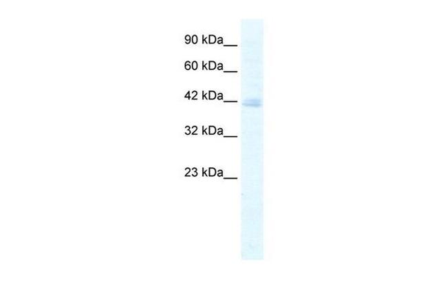 KCTD18 Antibody in Western Blot (WB)