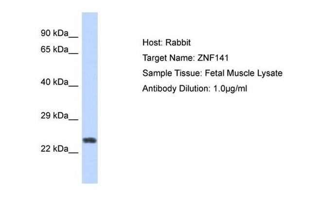 ZNF732 Antibody in Western Blot (WB)
