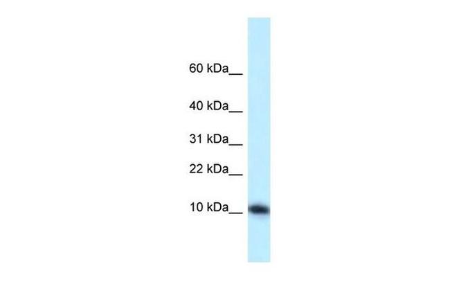 MED21 Antibody in Western Blot (WB)