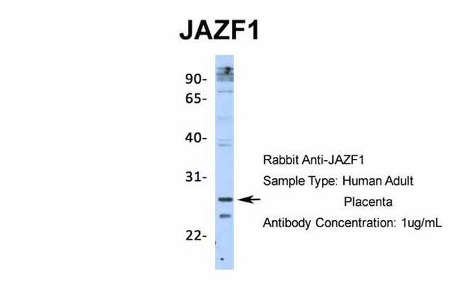 JAZF1 Antibody in Western Blot (WB)