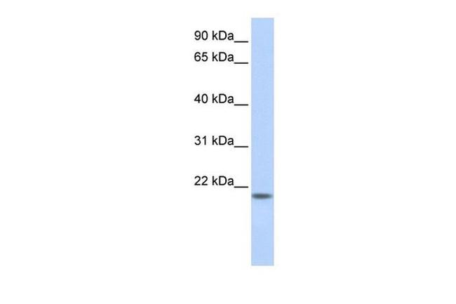 C20orf203 Antibody in Western Blot (WB)