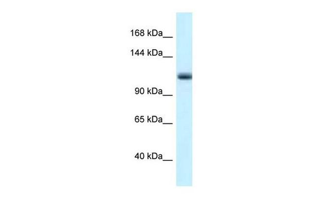 MCM10 Antibody in Western Blot (WB)