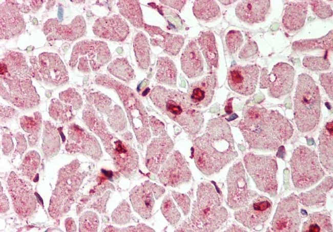 MXI1 Antibody in Immunohistochemistry (Paraffin) (IHC (P))